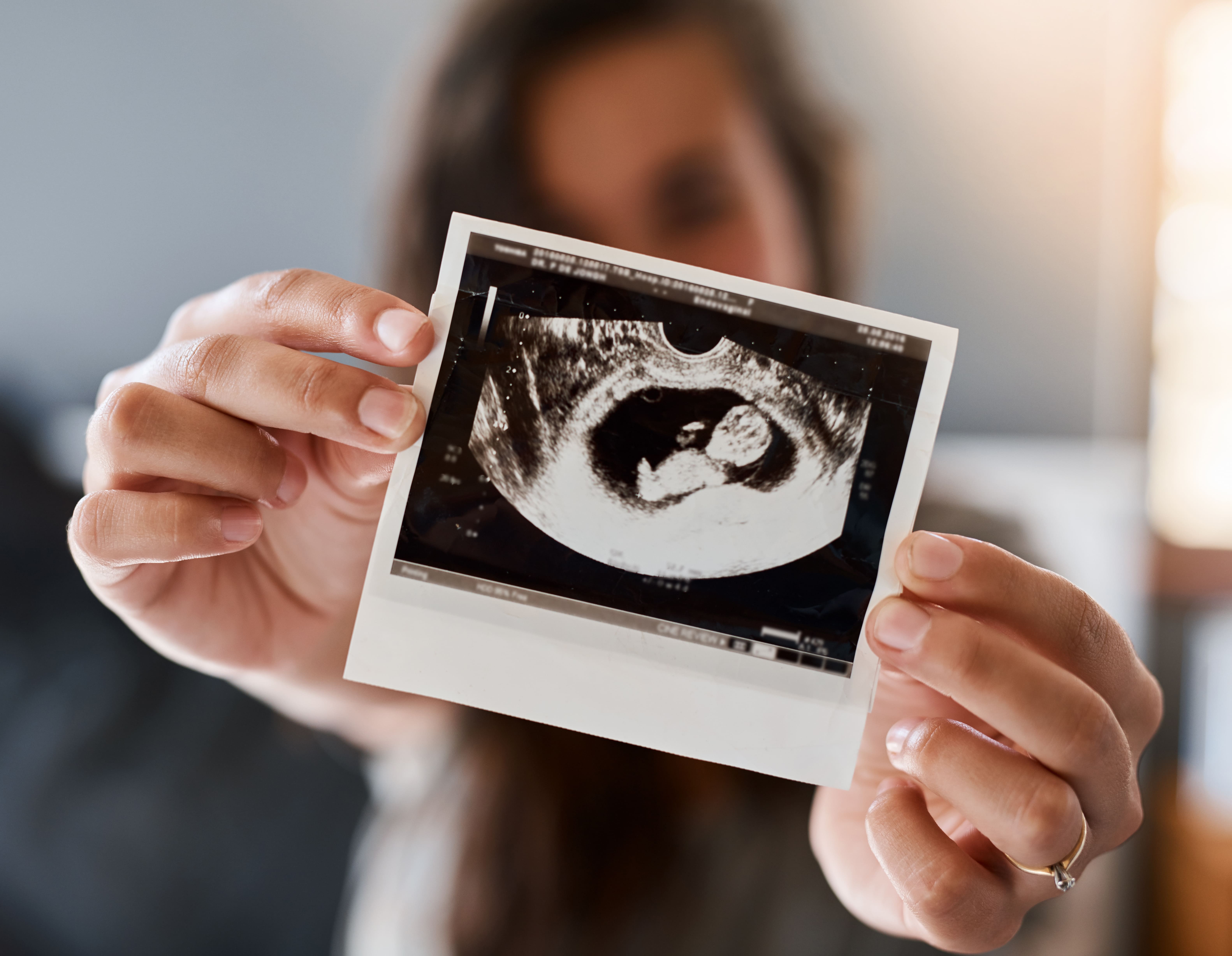 babys-growing-beautifully-2025-04-06-08-45-18-utc (1)